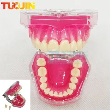 Nova Dental Typodont Modelo Removível Com Dentes De Goma Macia Extração Dentária Prática Do Modelo Dental Modelos Para A Educação Do Paciente Demo